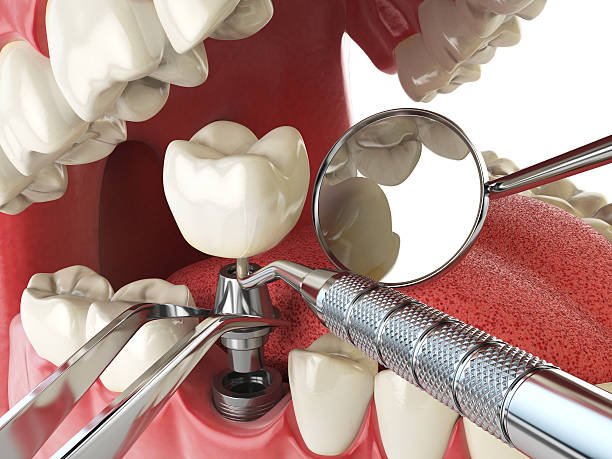 Best Emergency Dental Care for Trauma or Injury in Bratenahl, OH